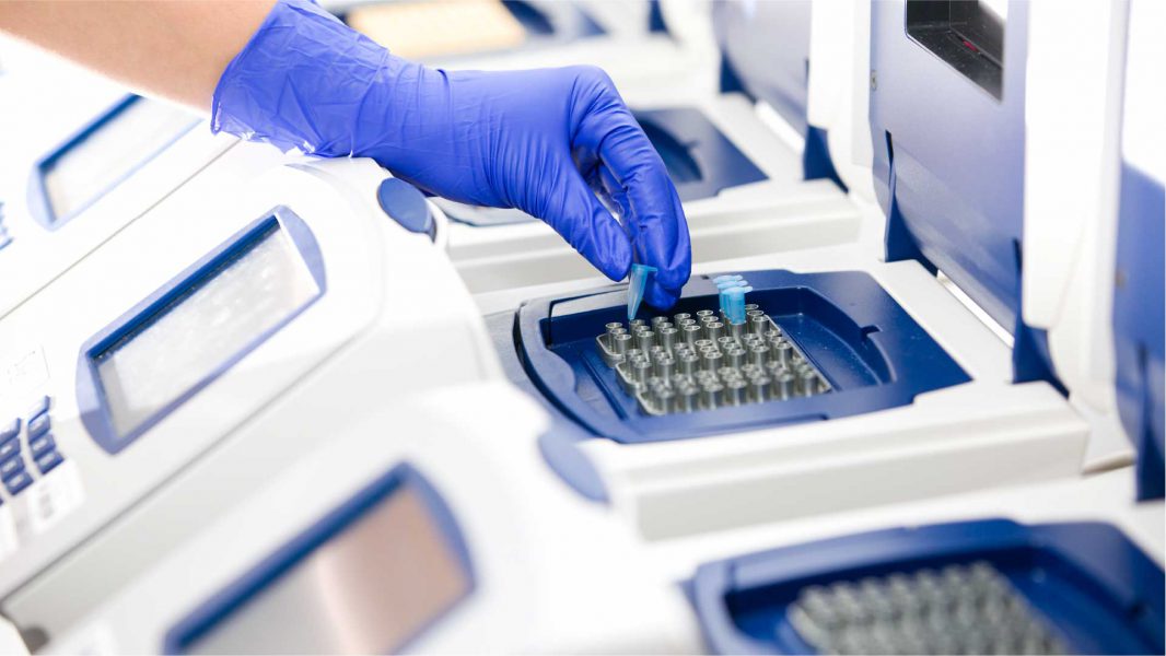 Laboratory-automation-equipment-application