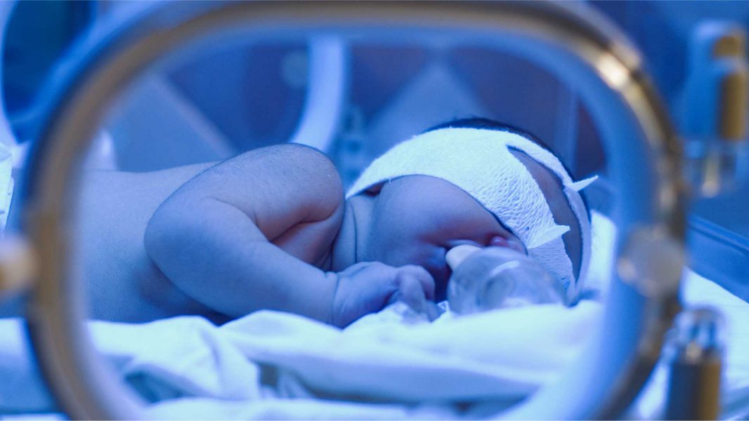 Life-support-application